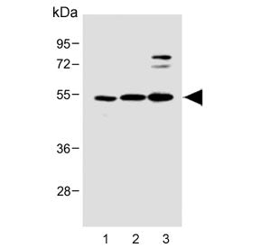 Western blot testing of human 1) U-2 OS, 2) SH-SY5Y and 3) MOLT4 cell lysate with LYK5 antibody. Pre