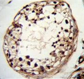 IHC testing of FFPE human testis tissue with TSPYL6 antibody. HIER: steam section in pH6 citrate buf