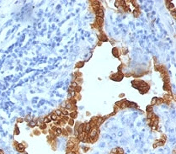 Cytokeratin 8 /18 Antibody