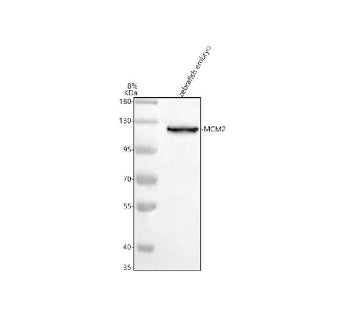 Western blot analysis of Mcm2 protein using Mcm2 antibody and zebrafish embryo tissue lysate. The pr