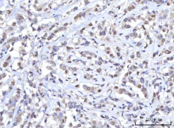 RANBP2 Antibody