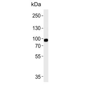 Western blot testing of human HEK293 cell lysate with Phospholipase A2 antibody. Predicted molecular