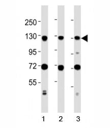 Western blot testing of MCM2 antibody at 1:2000 dilution. Lane 1: Jurkat lysate; 2: MCF-7 lysate; 3: