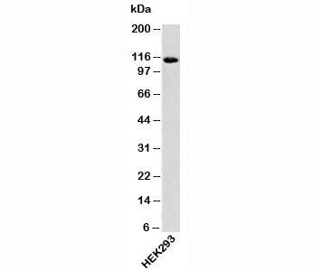 Western blot testing of human samples with Importin-9 antibody at 0.25ug/ml.