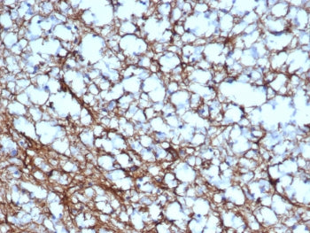 IHC staining of FFPE human cerebellum tissue with GFAP antibody (clone GFAP/6878). HIER: boil tissue