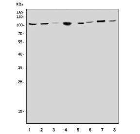 CLCN5 Antibody / CIC-5 antibody