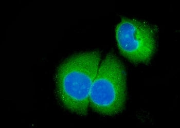 Immunofluorescent staining of FFPE human SiHa cells with Caspase-3 antibody (green) and DAPI nuclear