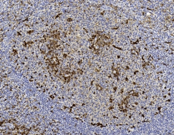 GST pi Antibody / GSTP1