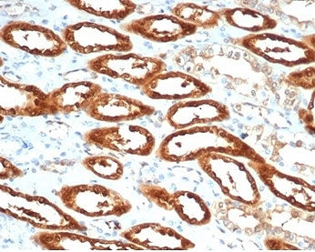 IHC staining of FFPE human kidney tissue with CKB antibody (clone CKBB/6565). HIER: boil tissue sect