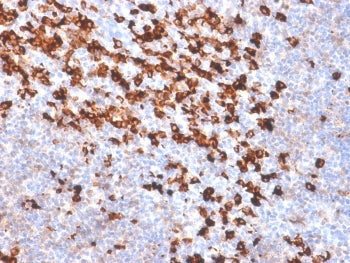 IHC: Formalin-fixed, paraffin-embedded human tonsil stained with biotinylated Kappa Light Chain Ab p