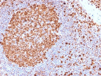 IHC testing of FFPE human tonsil with recombinant MCM7 antibody. Required HIER: boil tissue sections