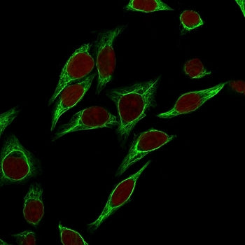 Immunofluorescent staining of permeabilized human HeLa cells with Cytokeratin 18 antibody (clone SPM