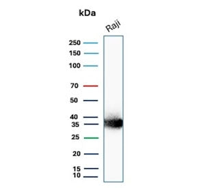 Western blot testing of human Raji cell lysate with recombinant CD74 antibody (clone CLIP/3127R). Ex