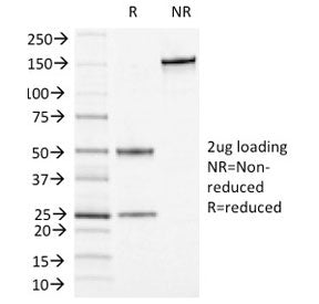 SDS-PAGE analysis of purified, BSA-free CD13 antibody (clone APN/1464) as confirmation of integrity 