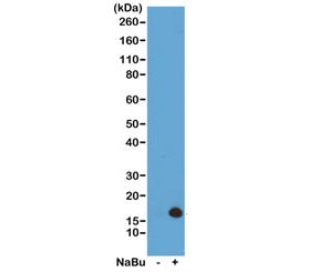 Western blot of acid extracts from HeLa cells untreated (-) or treated (+) with sodium butyrate usin