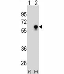 Western blot analysis of CDC25C antibody and 293 cell lysate (2 ug/lane) either nontransfected (Lane