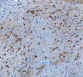 IHC-P staining of mouse brain tissue with BDNF antibody. HIER: steam section in pH8 EDTA buffer for 