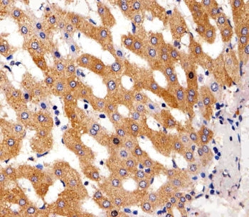 IHC testing of FFPE human liver tissue with Phenylalanine hydroxylase antibody. HIER: steam section 