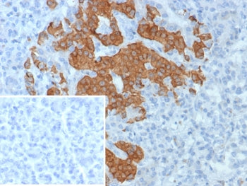 IHC staining of FFPE human pancreas tissue with GAD2 antibody (clone GAD2/8394R). Inset: PBS used in