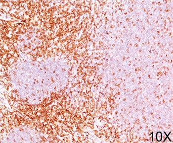 CD6 Antibody