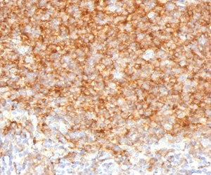 IHC testing of human tonsil with CD40 antibody (clone CDLA40-1). Required HIER: boil tissue sections