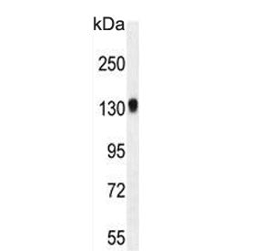 Western blot testing of mouse bladder tissue lysate with TDRD7 antibody. Expected molecular weight: 