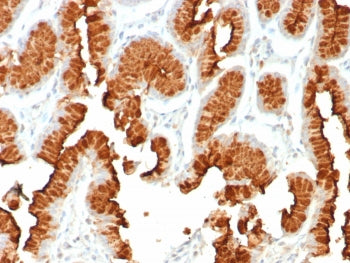 IHC staining of FFPE human stomach tissue with MUC5AC antibody (clone rMUC5AC/8052) at 2ug/ml. HIER: