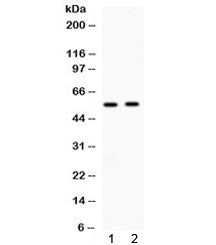 ALDH3A2 Antibody