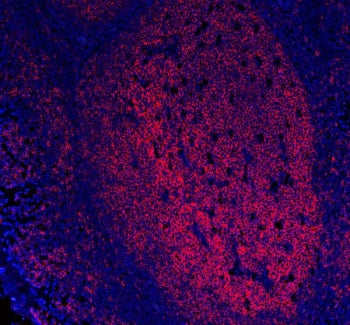 Immunofluorescent staining of FFPE human tonsil tissue with MS4A1 antibody (red) and DAPI nuclear st
