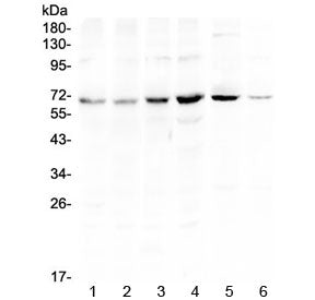 Western blot testing of human 1) HeLa, 2) U-87 MG, 3) COLO320, 4) HepG2, 5) rat brain and 6) mouse N
