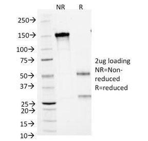 SDS-PAGE Analysis of Purified, BSA-Free SCLC Marker Antibody (clone MOC-52). Confirmation of Integri