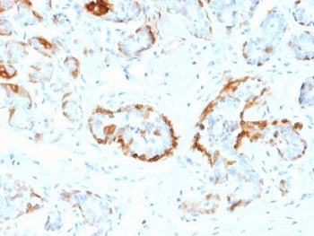 IHC staining of FFPE human breast tissue with CRYAB antibody (clone CPTC-CRYAB-1). HIER: boil tissue