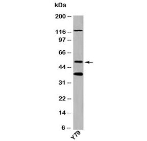Western blot testing of human samples with TXNIP antibody at 1ug/ml.