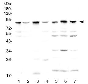 Western blot testing of human 1) HeLa, 2) HepG2, 3) 22RV1, 4) MCF7, 5) rat thymus, 6) rat kidney and