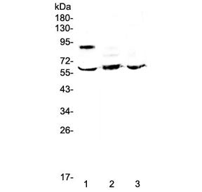 Western blot testing of human 1) placenta, 2) HepG2 and 3) MCF7 lysate with HSF2 antibody at 0.5ug/m