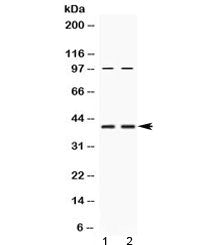 RPSA Antibody / 40S Ribosomal protein SA