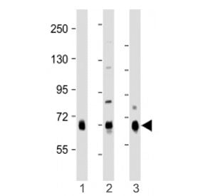 Western blot testing of DLL4 antibody at 1:1000: Lane 1) human lung, 2) mouse kidney and 3) rat lung