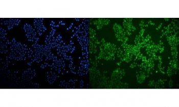 LXRB Antibody / NR1H2
