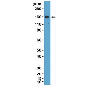Western blot testing of human Daudi cell lysate with recombinant CD21 antibody at 1:400 dilution. Pr