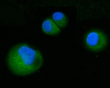 Immunofluorescent staining of FFPE human T-47D cells with Amiloride binding protein 1 antibody (gree