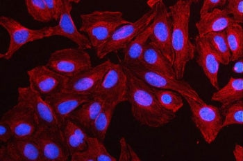 Immunofluorescent staining of FFPE human U-2 OS cells with MMP19 antibody (red) and DAPI nuclear sta