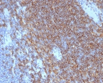 IHC staining of FFPE human lymph node with CD4 antibody (clone CD4/7142) at 2ug/ml in PBS for 30min 