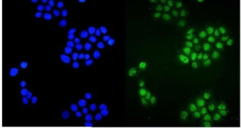 Immunofluorescent staining of FFPE human A431 cells with ZBTB16 antibody (green) and DAPI nuclear st