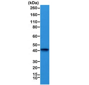 Western blot testing of mouse heart lysate with recombinant ACTC1 antibody at 1:1000. Predicted mole