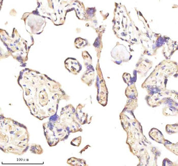 Immunohistochemical staining of MEST using anti-MEST antibody. MEST was detected in a paraffin-embed