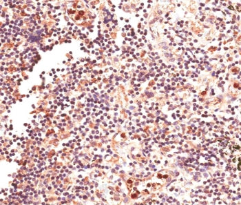 IHC testing of FFPE human lymph node tissue with GLI2 antibody at 4ug/ml. HIER: steam section in pH6