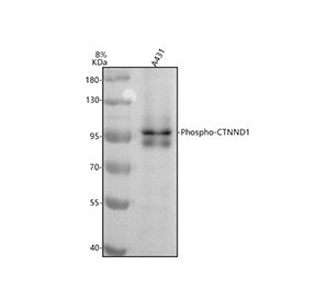 Western blot testing of human A431 cell lysate with Phospho-p120 Catenin (Tyr228) antibody. Predicte