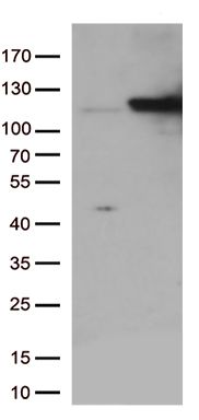 IDE Mouse Monoclonal Antibody [Clone ID: OTI4E5]