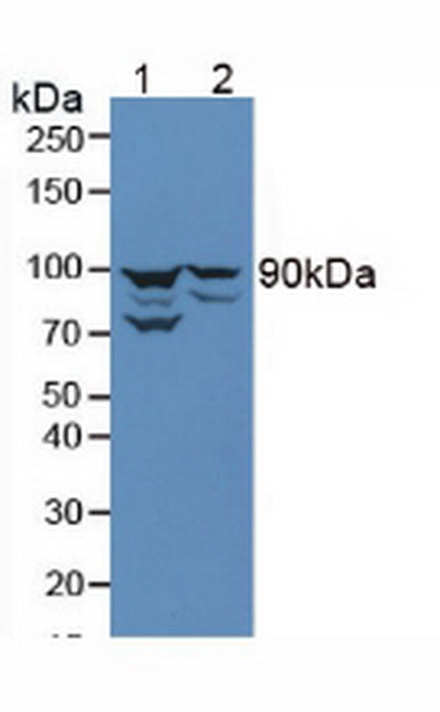 Anti-Beta Catenin (β-catenin) Polyclonal Antibody
