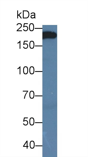 Anti-Beta Catenin (β-catenin) Monoclonal Antibody